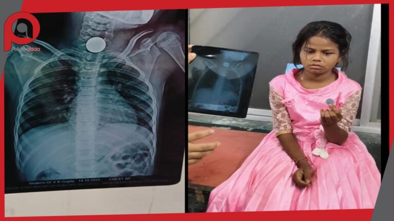 आठ साल की बच्ची के गले में फंसा दो रुपये का सिक्का, डॉक्टर की सूझबूझ से बची मासूम की जान