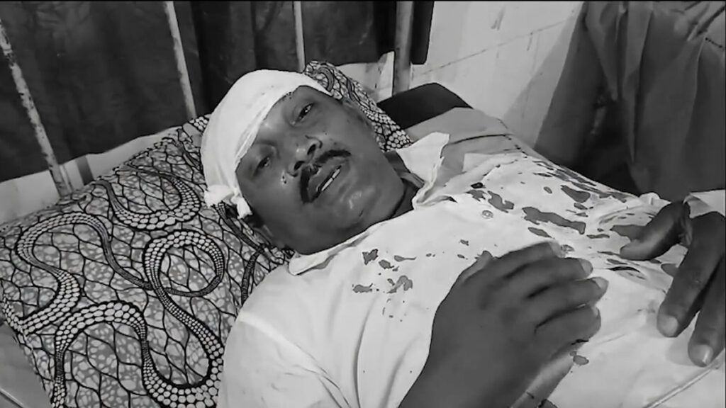 नदिया में भाजपा पोलिंग एजेंट हमला