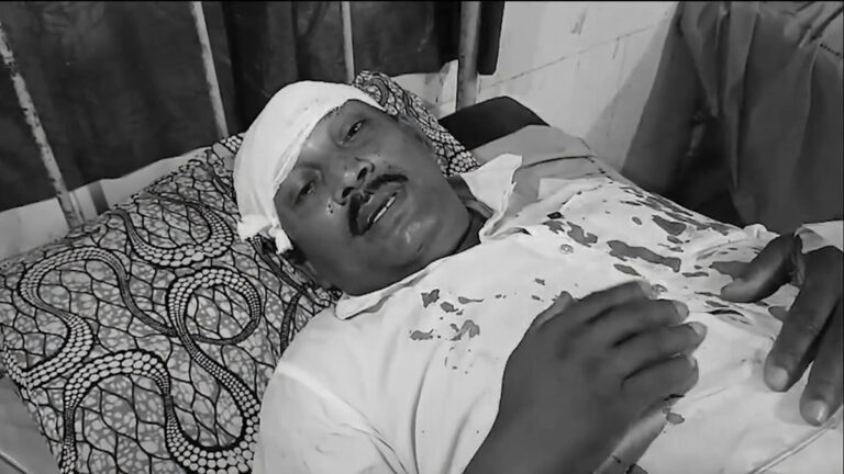 नदिया में भाजपा पोलिंग एजेंट हमला